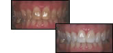 before and after