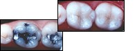 before and after