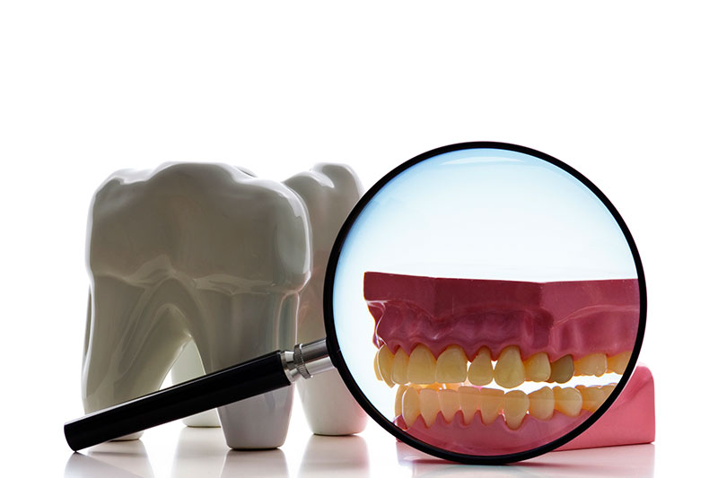 Root Canal Treatment in Massapequa